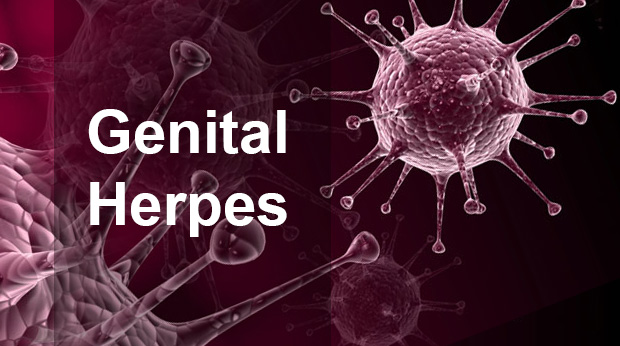 Genital Herpes