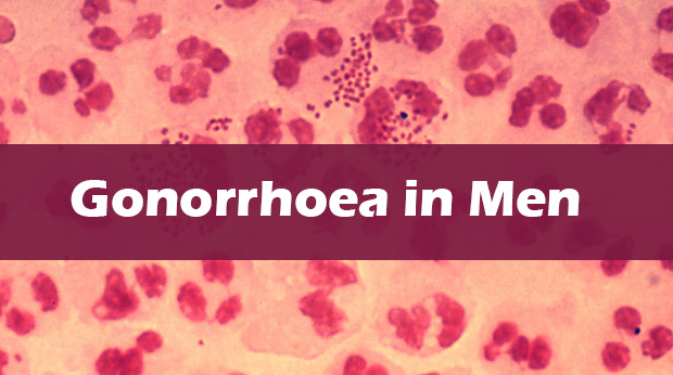 Gonorrhoea in Men
